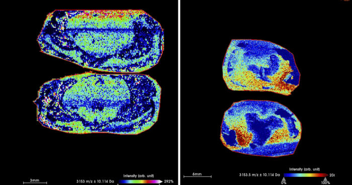 Imagem à esquerda mostra o cérebro de ratos que não consumiram o diacetil. Já a da direita exibe o cérebro dos animais que ingeriram o composto, indicando forte presença de proteínas beta-amiloides (pontos em vermelho) – Foto: Lucas Ximenes